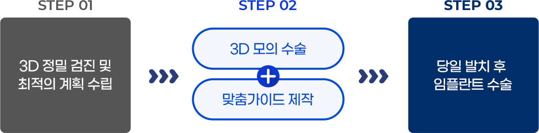 원데이 임플란트 STEP